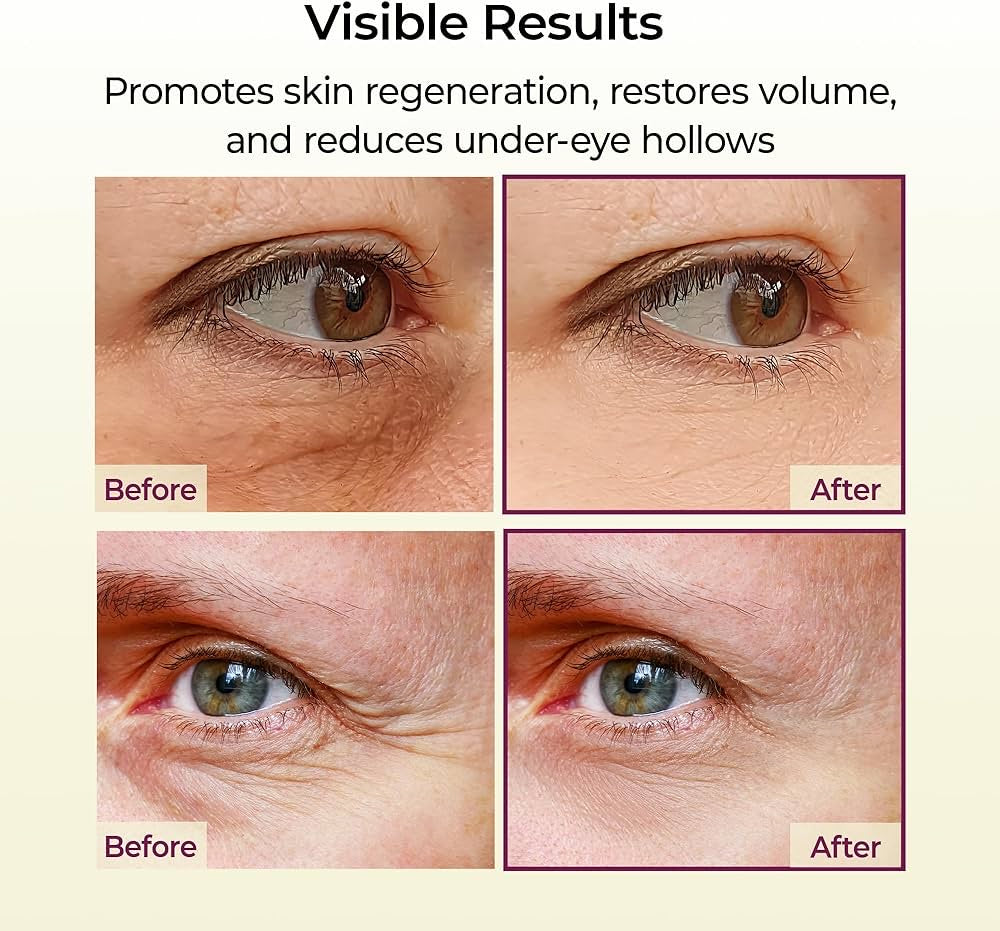 2-piece Dr.Melaxin Cemenrete Calcium Multi Balm 9g Skin Care All In One Calcium Volume Stick Collagen Wrinkles Face Eye treatment Balm